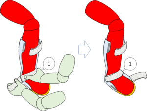 介護技術の骨 コツ 下肢装具の着脱介助で外せない３つのポイント 4コマ漫画で考えるリハビリ脳の作り方